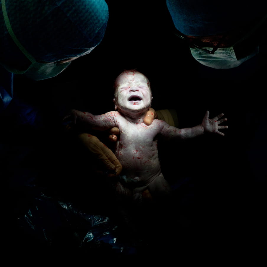 Two faces of doctors with surgical masks and gloved hands holding upright a still bloody newborn baby, with umbilical cord still attached; against black background.
