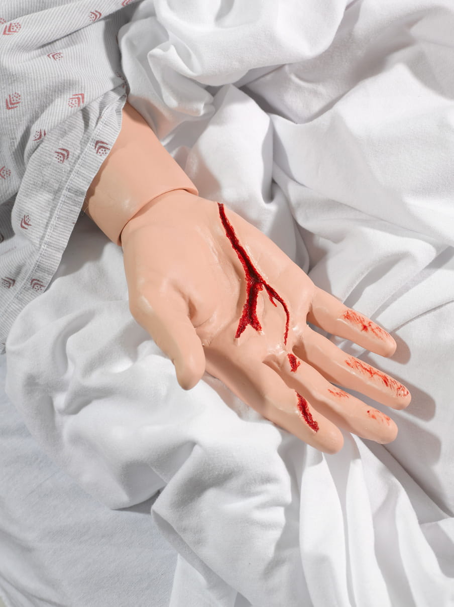 Close up photo of a plastic hand showing a deep cut - on a white hospital bed