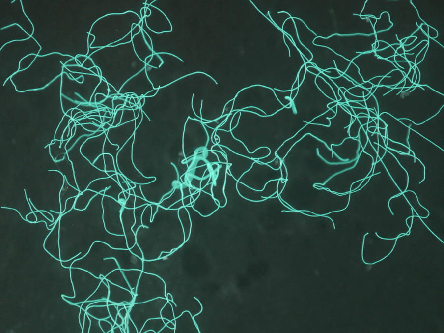 Close up photograph of fluorescent turquoise threads which look like luminous squiggles on a dark green background.  

