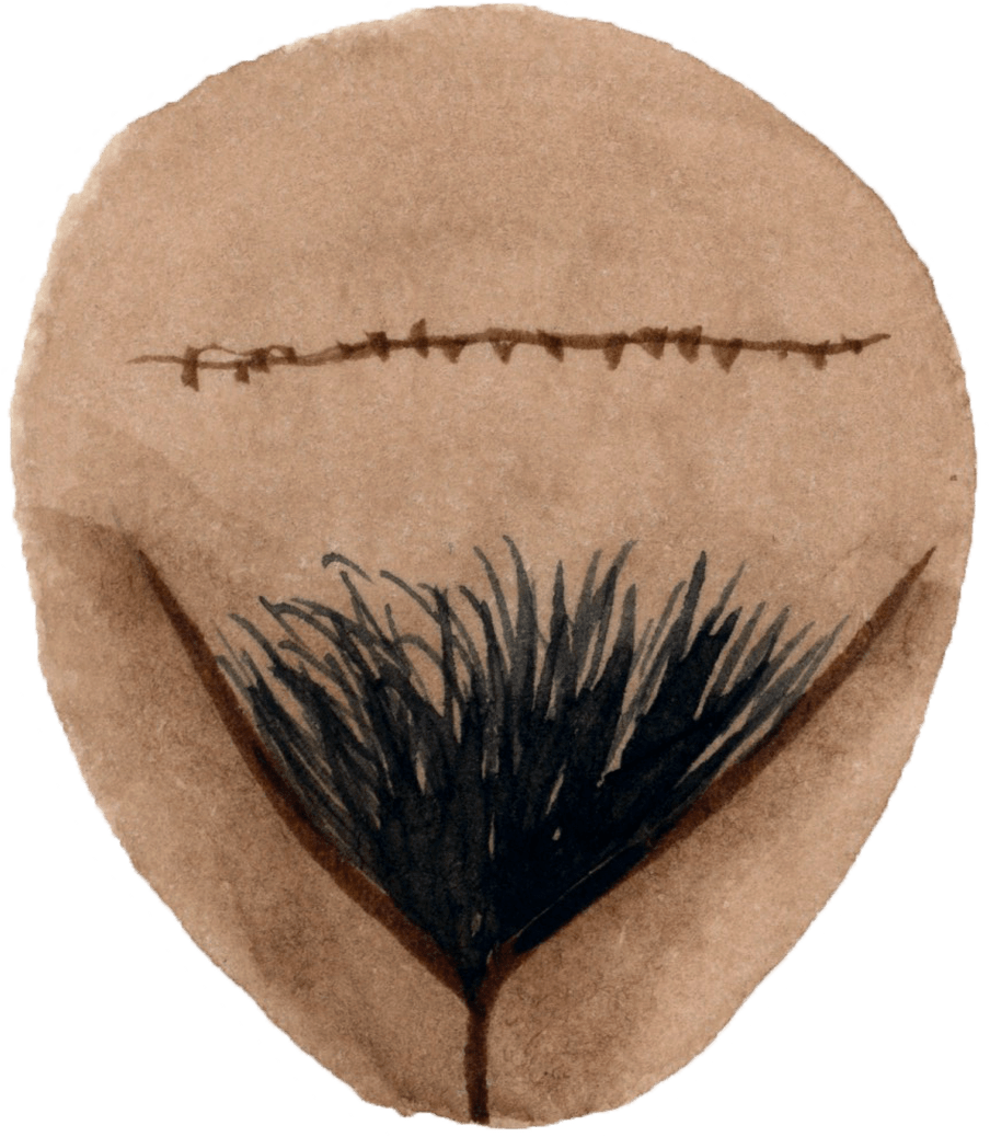 Illustration of a vulva with black curly dark hair above it and a scar above it