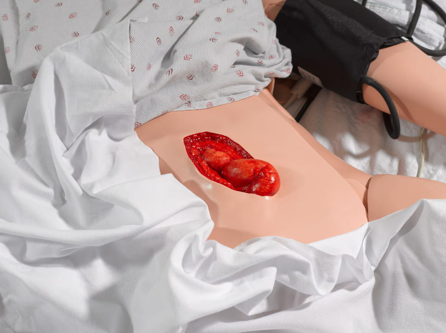 Close up photo of a fake operation on a plastic doll, belly exposed showing, fake organs.