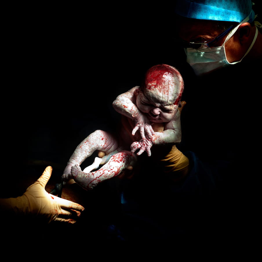 A doctor with gloved hands holding upright still bloody newborn baby, umbilical cord still attached; against black background. 